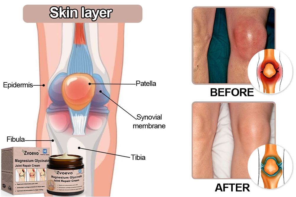 ✅ MHRA Approved: Zvoevo® Magnesium Pain Relief Cream (Fast, Targeted Relief for Arthritis, Nerve Pain, Muscle Spasms, Rheumatism & Sports Injuries)