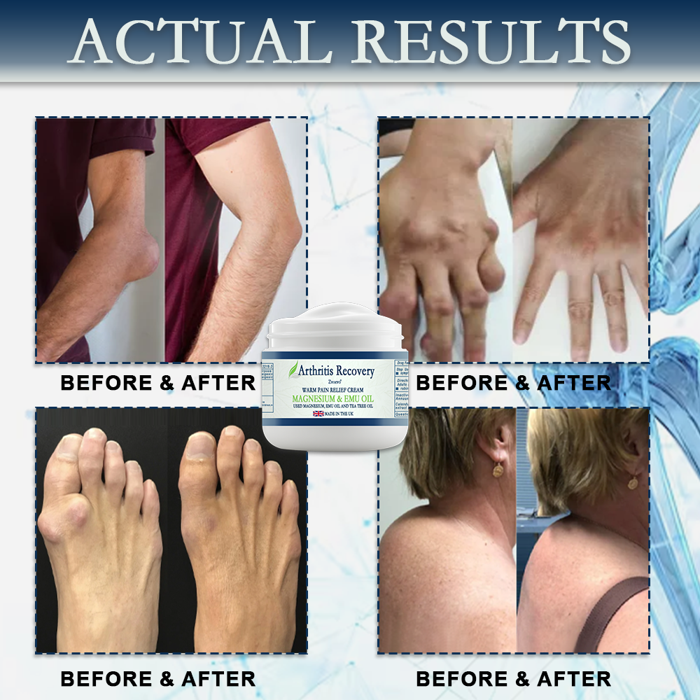 ✨ MHRA Approved: Zvoevo® Magnesium & Emu Oil Bone Relief Cream (Treatment for arthritis, neuropathyy, rheumatic diseases, muscle spasms, sports injuries and twitches )