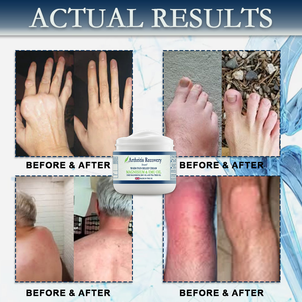 ✨ MHRA Approved: Zvoevo® Magnesium & Emu Oil Bone Relief Cream (Treatment for arthritis, neuropathyy, rheumatic diseases, muscle spasms, sports injuries and twitches )