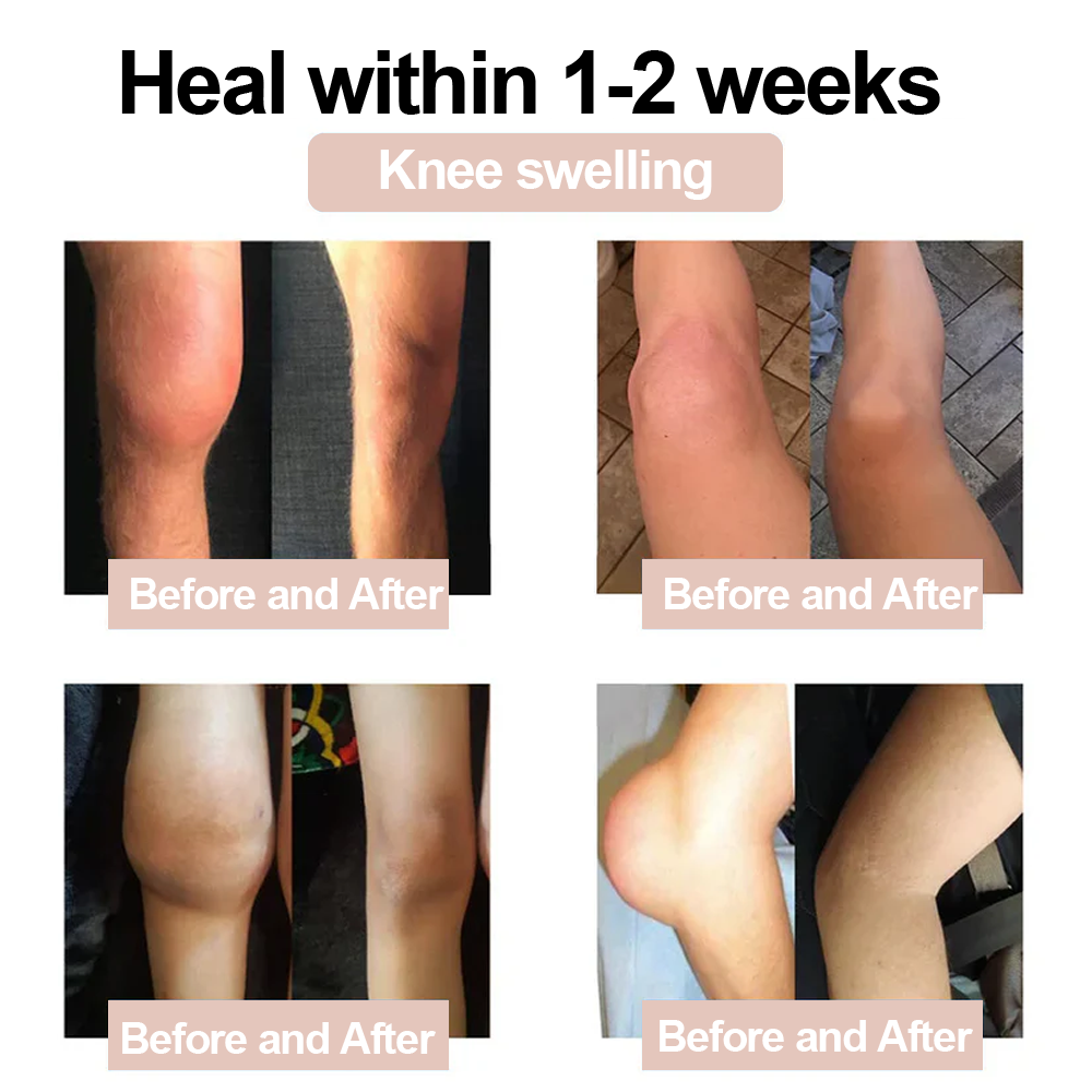✅ MHRA Approved: Zvoevo® Magnesium Pain Relief Cream (Fast, Targeted Relief for Arthritis, Nerve Pain, Muscle Spasms, Rheumatism & Sports Injuries)
