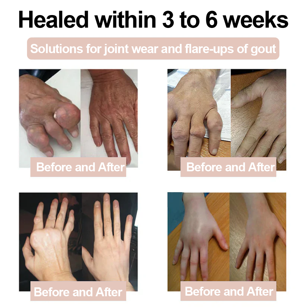 ✅ MHRA Approved: Zvoevo® Magnesium Pain Relief Cream (Fast, Targeted Relief for Arthritis, Nerve Pain, Muscle Spasms, Rheumatism & Sports Injuries)