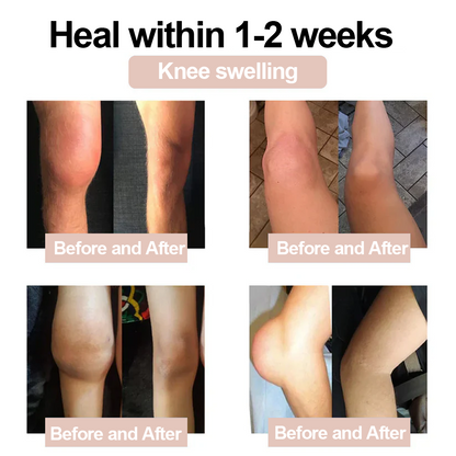 ✅ MHRA Approved: Zvoevo® Magnesium Pain Relief Cream  (Fast, Targeted Relief for Arthritis, Nerve Pain, Muscle Spasms, Rheumatism & Sports Injuries)