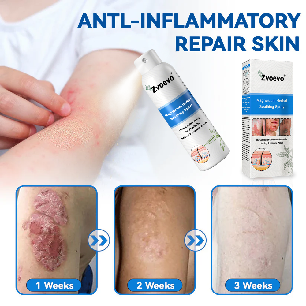 ✅ Official Store: Zvoevo® Magnesium Herbal Psoriasis Spray 👨‍⚕️ MHRA Approved (for the treatment of psoriasis and eczema, improvement of bacterial infections in the genital area, treatment of acne and warts)