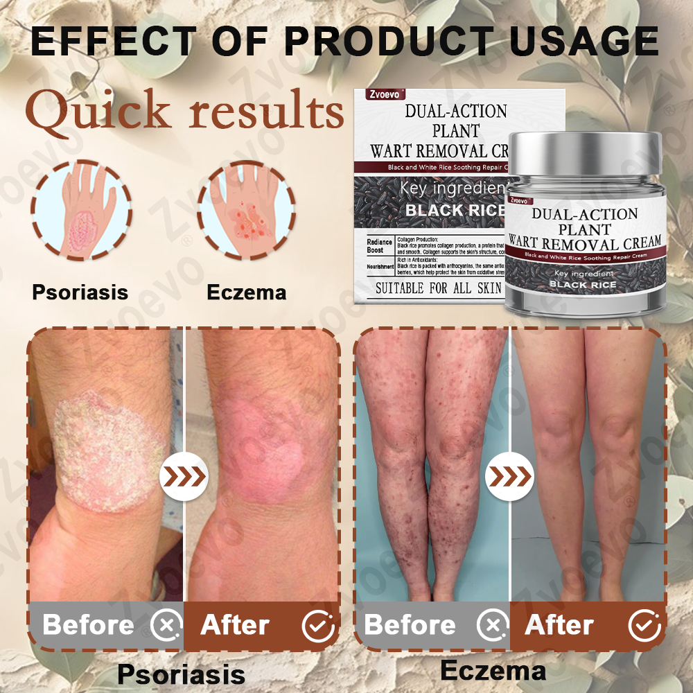 🌟Official Store: Zvoevo® Black Rice Skin Repair Essence Cream 👨‍⚕️ MHRA Certified (Eliminates warts and skin tags, relieves psoriasis, improves keratin build-up and follicular keratinization, fades pigmentation, age spots & sun spots)