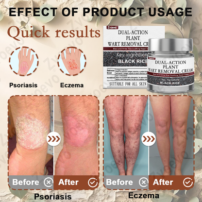🌟Official Store: Zvoevo® Black Rice Skin Repair Essence Cream 👨‍⚕️ MHRA Certified (Eliminates warts and skin tags, relieves psoriasis, improves keratin build-up and follicular keratinization, fades pigmentation, age spots & sun spots)